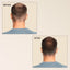 Hair Growth Oil